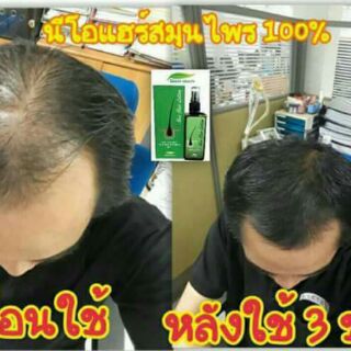 Neo Hair Lotion (Chuyên sỉ)