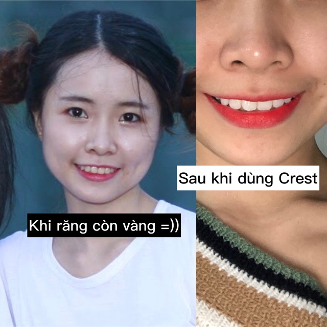 Miếng dán trắng răng ❤ FREESHIP (7 Gói-14 Miếng)  ❤ Liệu Trình 7 Ngày - 7 gói dán trắng răng crest , crest