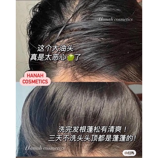 LƯỢC GỘI ĐẦU MASSAGE SILICONE