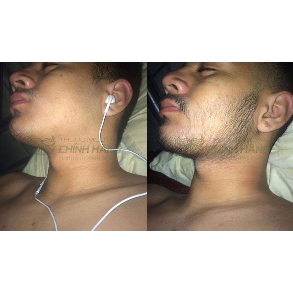 Biotin 10000 Mcg 100 Viên Của Mỹ