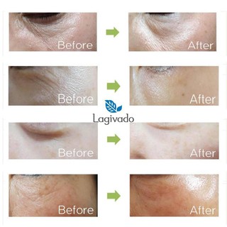 [ TẶNG 2 MIẾNG MẶT NẠ FACIAL MASK ] Bộ Tế Bào Gốc Trẻ Hóa Vùng Mắt Returning Dr Eye Patch Program