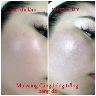 Mulwang X5 căng bóng da