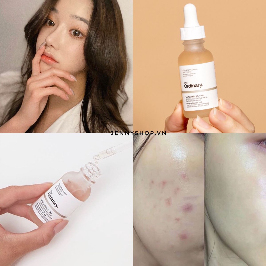 Serum Lactic acid 5%, 10% + HA the ordinary 30mil tẩy tế bào chết -  TOTO Shop