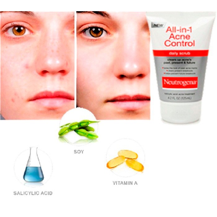 Sữa Rửa Mặt All In 1 Neutrogena Acne Control Daily Scrub (124ml) _ NTG002SRM