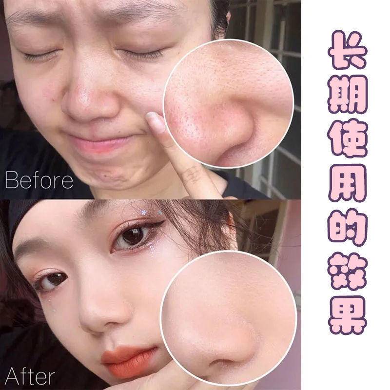 Phụ Kiện Cho Máy Hút Bụi TWG TWG® Mặt Nạ Bùn Làm Sạch Sâu Lỗ Chân Lông Dưỡng Ẩm Kiềm Dầu Chống Oxy Hóa