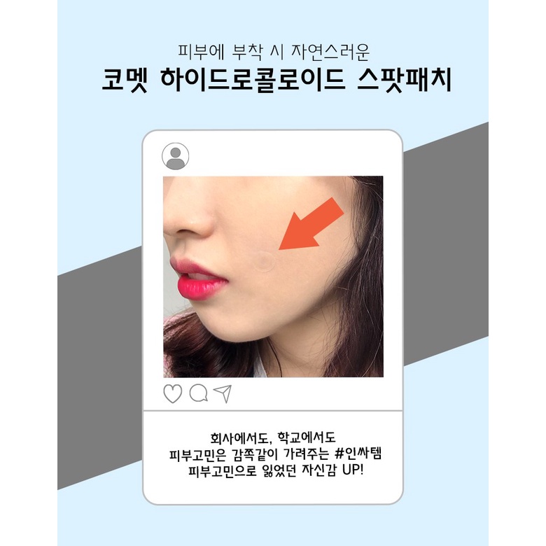 Miếng dán mụn che khuyết điểm, bảo vệ da và giảm sẹo thâm Comet hộp 120 cái 10mm x 10mm