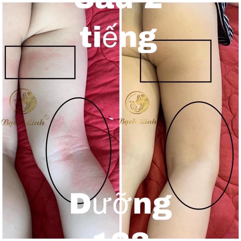 Dưỡng da 123 Bách Y Sâm Nhất Mộc Hương | BigBuy360 - bigbuy360.vn