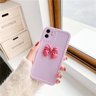 Ốp lưng iphone silicon nơ đáng yêu tiểu thư