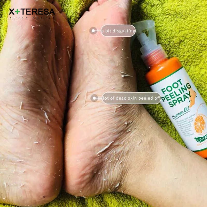 [HOT] ✨TẨY TẾ BÀO CHẾT CHÂN, KHUỶU TAY, ĐẦU GỐI DẠNG XỊT FOOT PEELING SPRAY ORANGE OIL✨