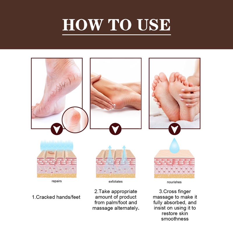 Kem Dưỡng Phục Hồi Da Chân Chống Nứt Nẻ Chống Khô Nứt Nẻ