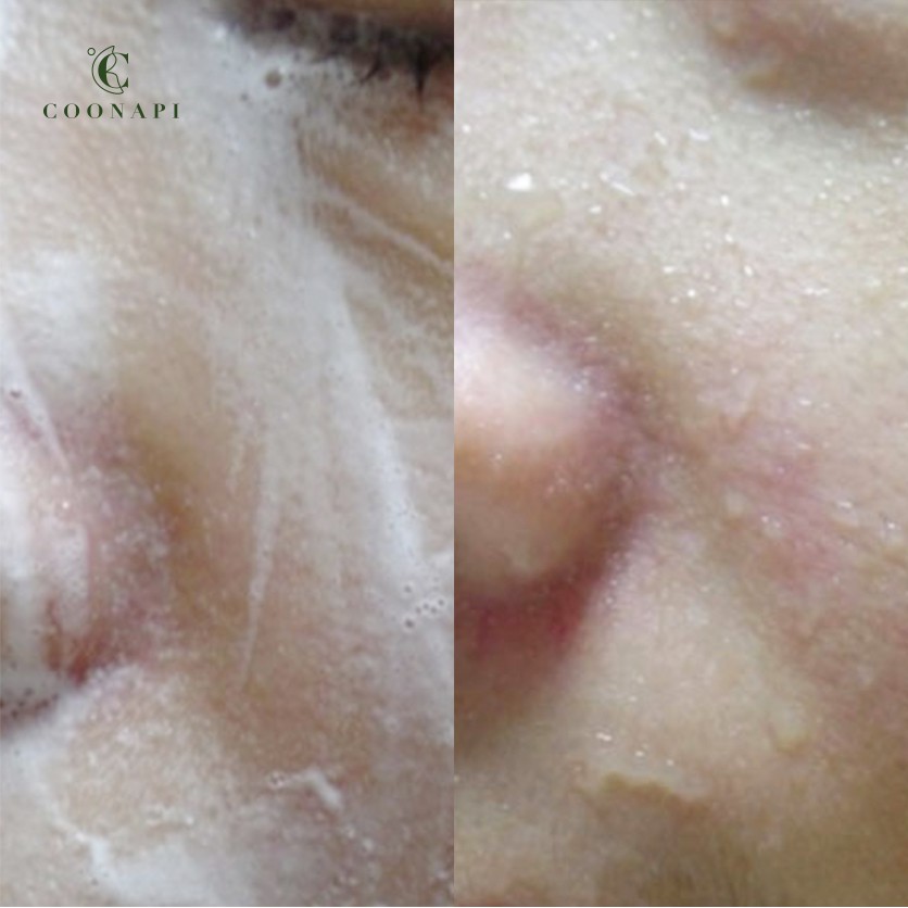 Sữa Rửa Mặt Cúc Xu Xi Làm Sạch Sâu All Natural Blooming Cleansing Foam 150g | BigBuy360 - bigbuy360.vn