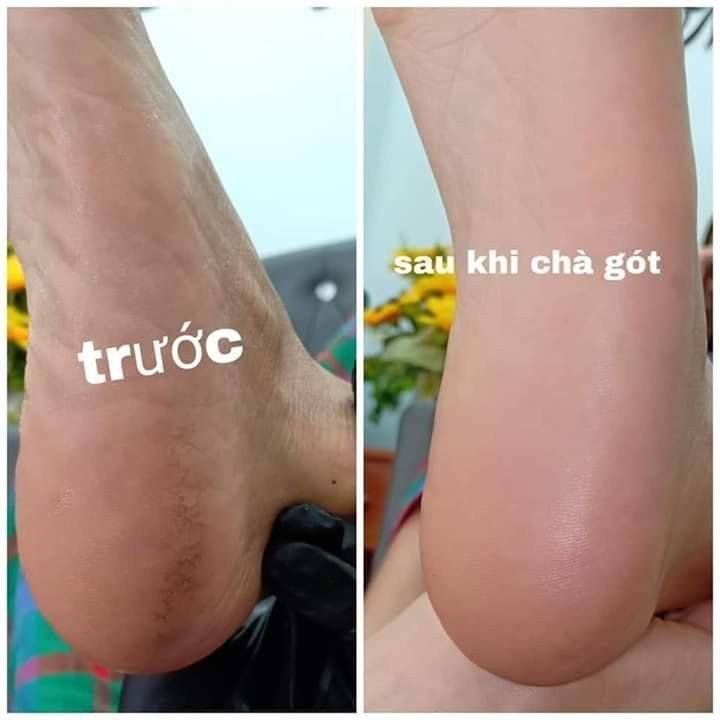 Cây chà gót inox, chà gót inox lỗ nhỏ