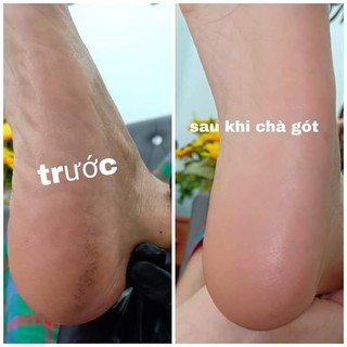 Máy chà gót chân màu đen, máy chà gót chân GH-99