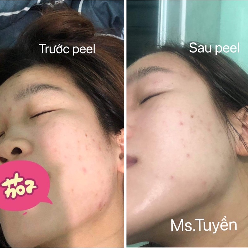 vi tảo sinh học set lẻ | BigBuy360 - bigbuy360.vn