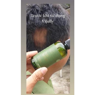 tinh dầu bưởi vijuly