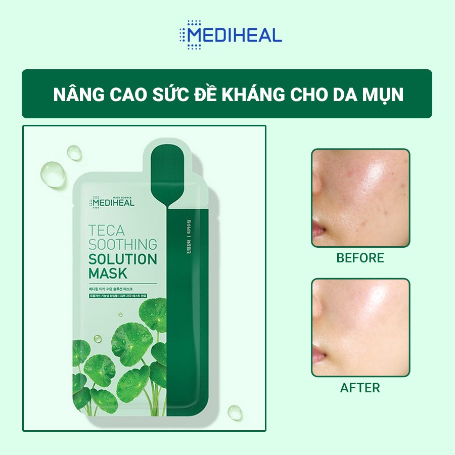 [Nhập mã COSMH22 giảm 8%] Mặt Nạ Dưỡng Da, Phục Hồi Chuyên Sâu Mediheal Solution Mask 21ml