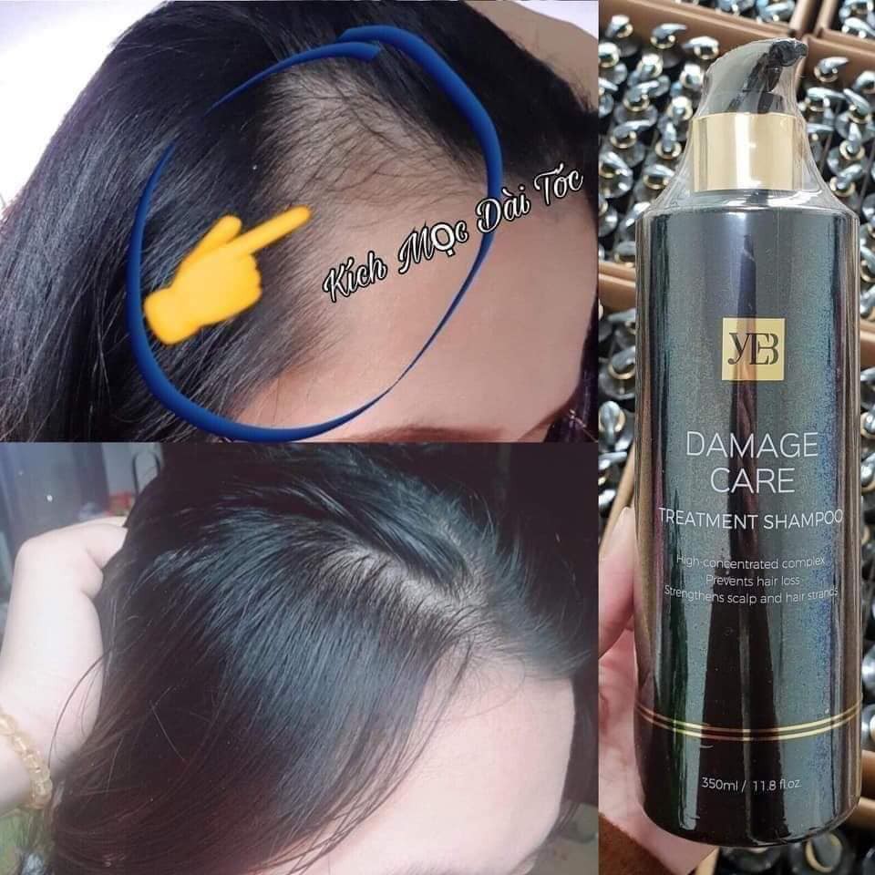 DẦU GỘI YB