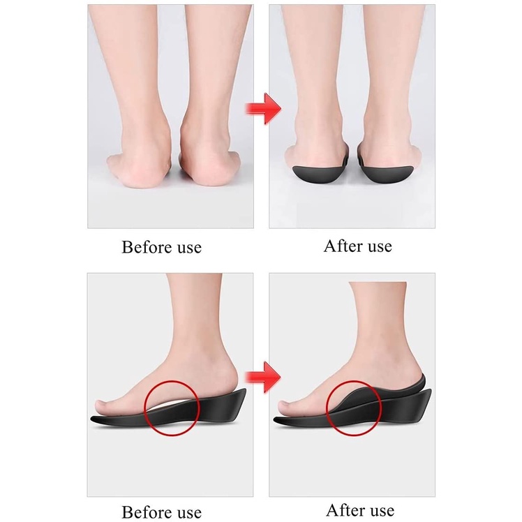 Miếng lót đế trong giày nam nữ mặt phẳng dáng cong hỗ trợ điều chỉnh cân gan chân / điều chỉnh ngón chân vẹo kiểu chữ 0