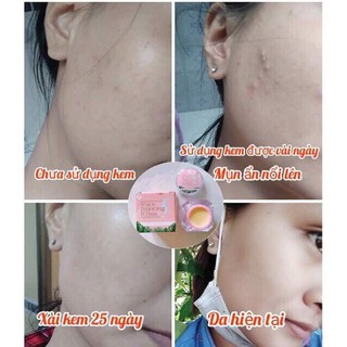 KEM FACE SỮA ONG CHÚA- S.O.N GROUP