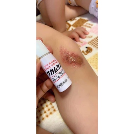 Gel đứt tay 10g Kobayashi Nhât | BigBuy360 - bigbuy360.vn