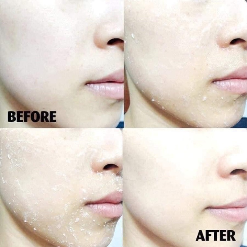 Gel Tẩy Tế Bào Chết Làm Mịn Da Bioderma Sebium Gel Gommant 100ml