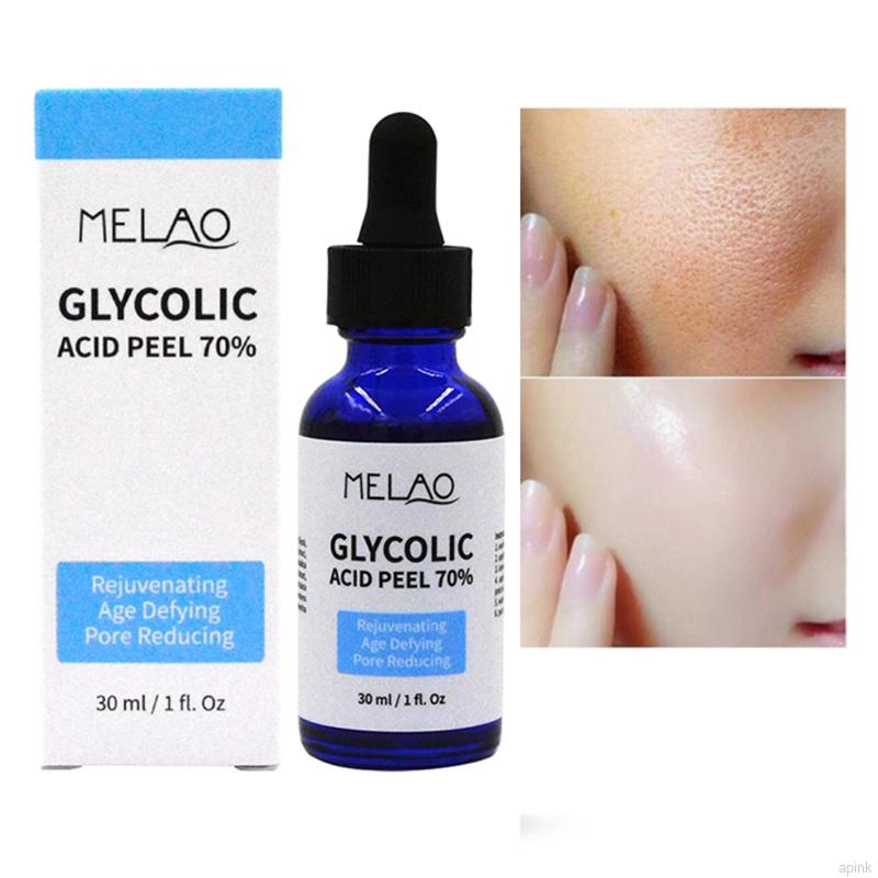 Serum Glycolic Acid 70% Làm Sáng Da Thu Nhỏ Lỗ Chân Lông Cân Bằng Nước Và Dầu Loại Bỏ Mụn