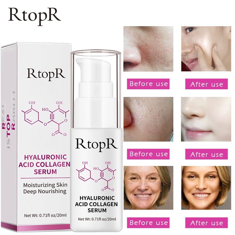 Tinh Chất Dưỡng RtopR Từ Hyaluronic Acid Collagen Hỗ Trợ Giảm Mụn Chống Nếp Nhăn Làm Trắng Da 20ml