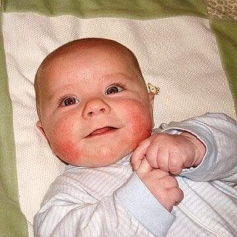 Kem dưỡng nẻ chàm cho bé Aveeno baby eczema therapy