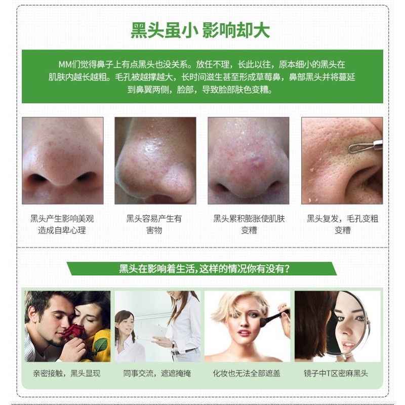 MẶT NẠ LỘT MỤN CÁM, MỤN ĐẦU ĐEN IMAGES | BigBuy360 - bigbuy360.vn