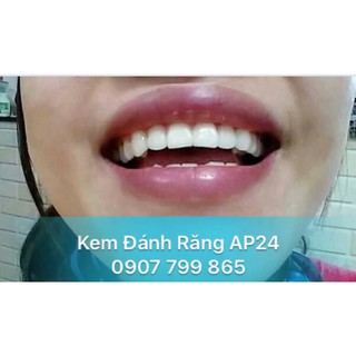 [CHUYÊN SỈ - INBOX] KEM ĐÁNH RĂNG AP24
