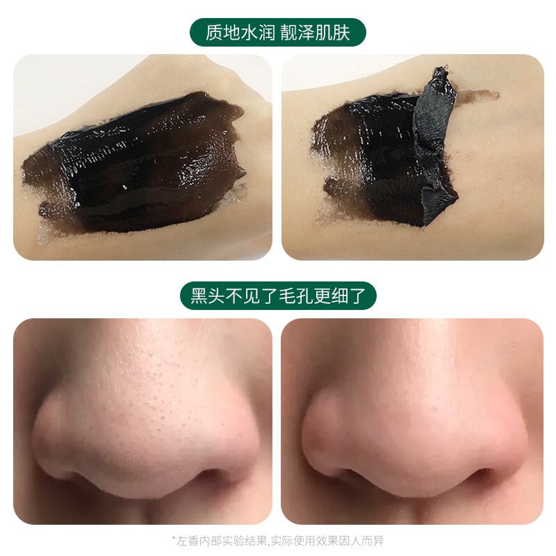 Tuýp Gel Lột Mụn Than Tre Black Head Remover