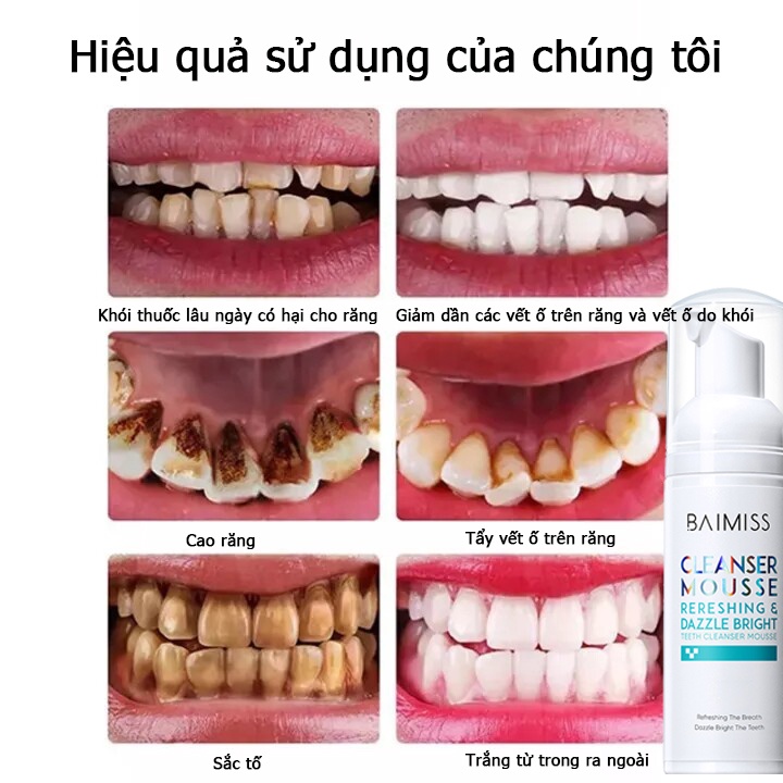 BAIMISS Bọt Tẩy Trắng Răng  Làm Sạch Răng Khử Mùi Hôi Miệng Mousse  Teeth Whitening Clean Teeth 60ml