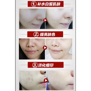 Tinh chất dưỡng da Meiking HA essence