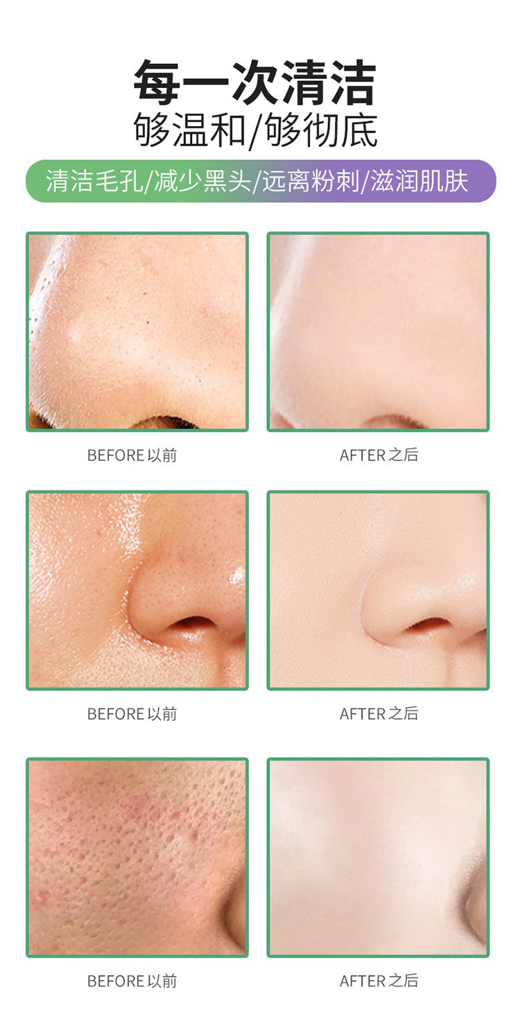 Mặt Nạ Trà Xanh/Cà Tím Lột Mụn Đầu Đen Kiểm Soát Dầu Làm Sạch Da Mặt Thương Hiệu Meidian | BigBuy360 - bigbuy360.vn