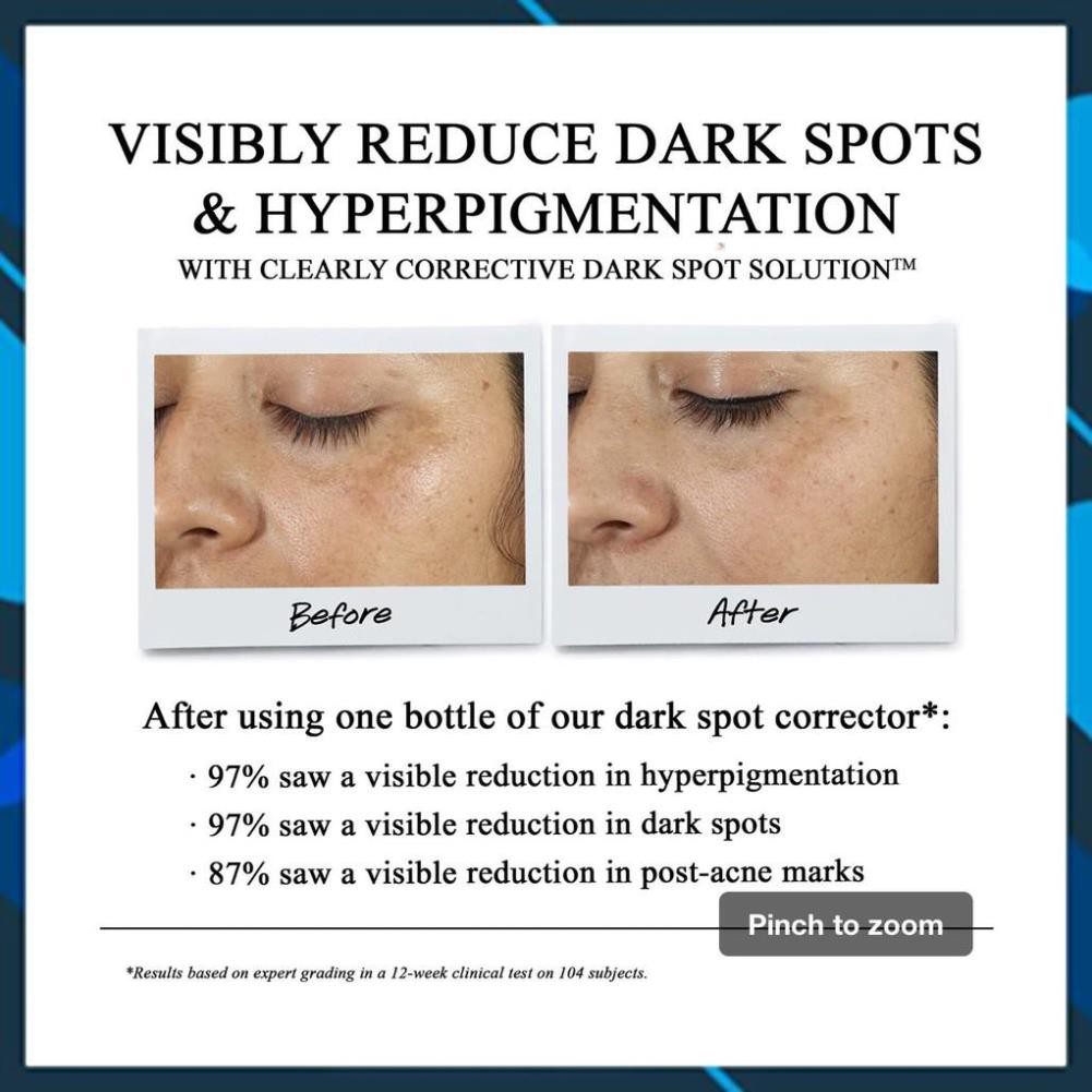 (✿◠‿◠) Tinh Chất Serum Làm Sáng Da & Mờ Thâm Mụn Clearly Corrective™ Dark Spot Solution⭐️Size 50 ml (◠‿◠✿)