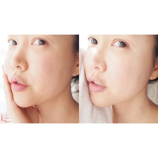 Mặt Nạ Chăm Sóc Da Hai Bước PUREDERM