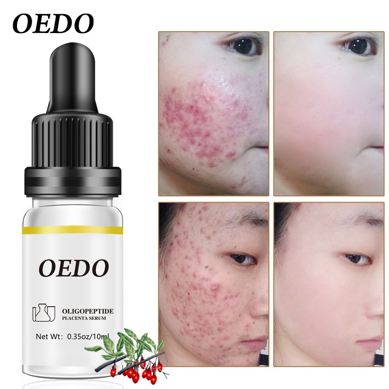 OEDO Serum dưỡng da Oligopeptide Placenta giữ ẩm phục hồi trắng chống lão hóa và nếp nhăn