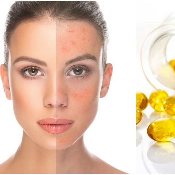 Viên Uống Tinh Dầu Hoa Anh Thảo Hàn Quốc Hanmi Gamma Hỗ Trợ Nội Tiết Tố Làm Da Mịn Màng Là Phụ Nữ Không Thể Không Uống | BigBuy360 - bigbuy360.vn