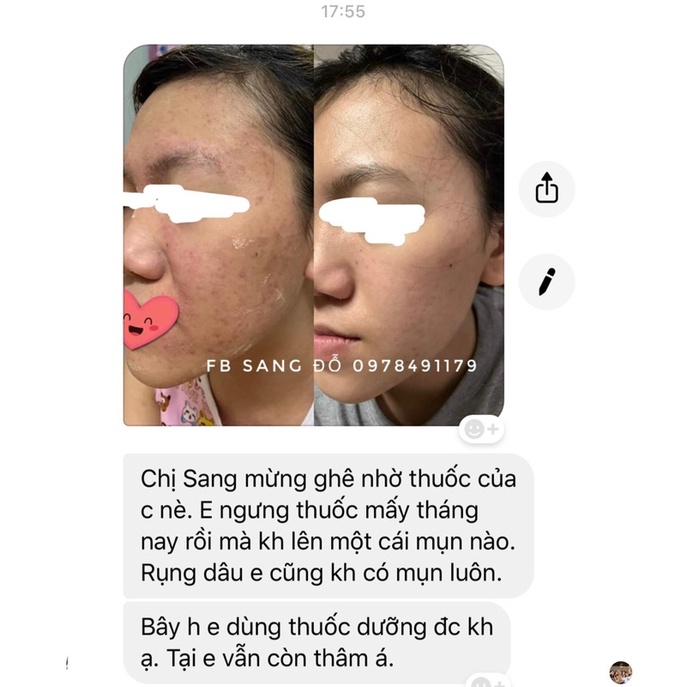 Thảo Dược Tái Tạo Da  125ml