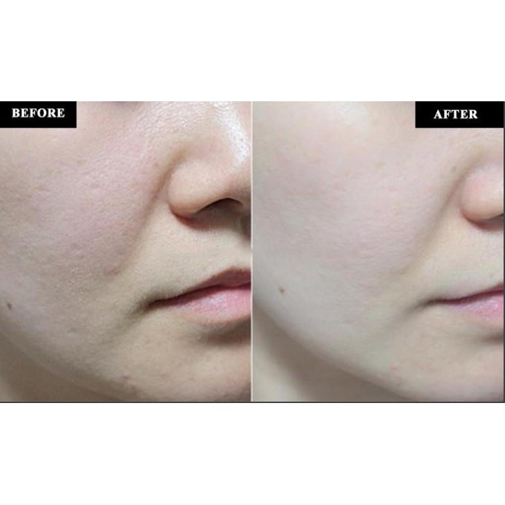 Toner xịt khoáng IyouB 𝐒𝐩𝐚𝐫𝐤𝐥𝐢𝐧𝐠 𝐌𝐢𝐧𝐞𝐫𝐚𝐥 𝐓𝐨𝐧𝐞𝐫 dịu da tức thì 160ml NPP Shoptido | BigBuy360 - bigbuy360.vn