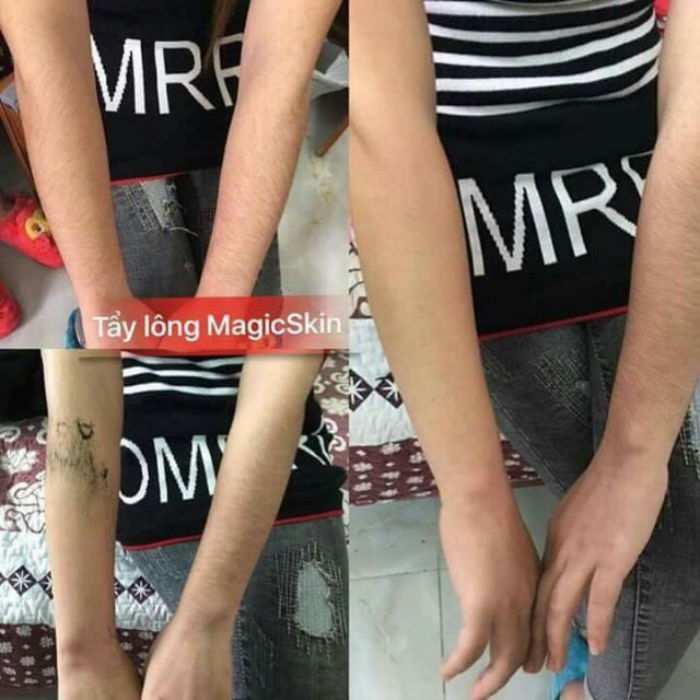 KEM TẨY LÔNG MAGIC SKIN | BigBuy360 - bigbuy360.vn