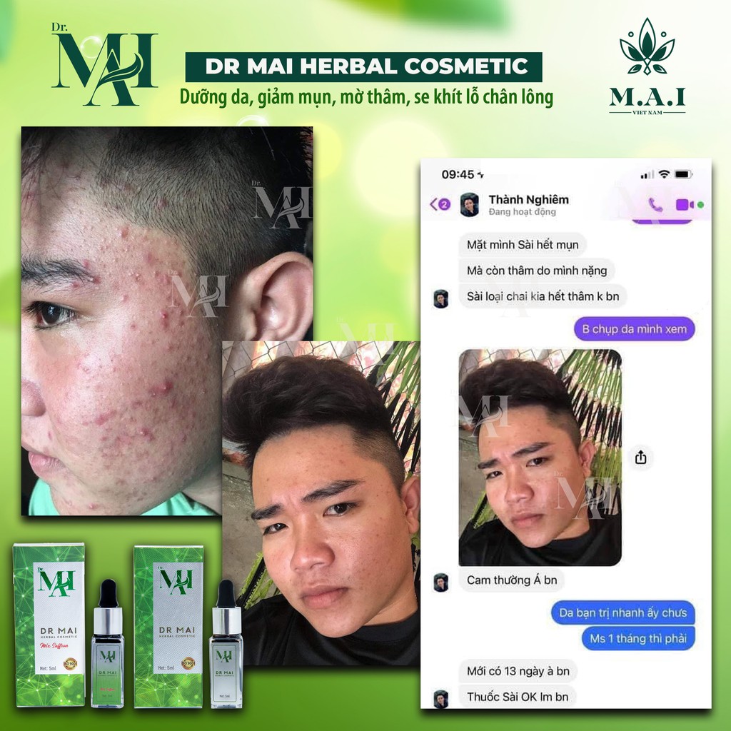 Dr Mai, Serum mụn Dr Mai 5ml, sạch mụn mờ thâm, mờ sẹo rỗ lựa chọn hoàn hảo cho da mụn | BigBuy360 - bigbuy360.vn