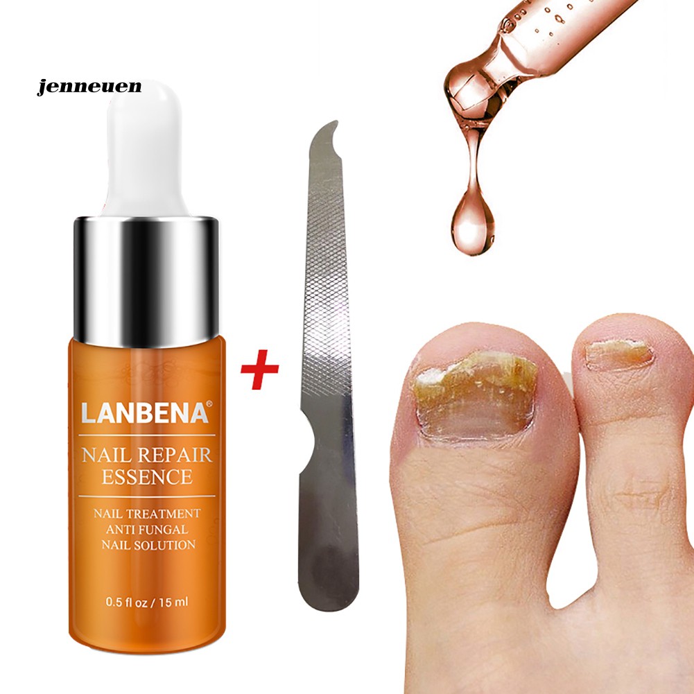 [Hàng mới về] Tinh chất phục hồi móng tay chống nấm 15ml | BigBuy360 - bigbuy360.vn