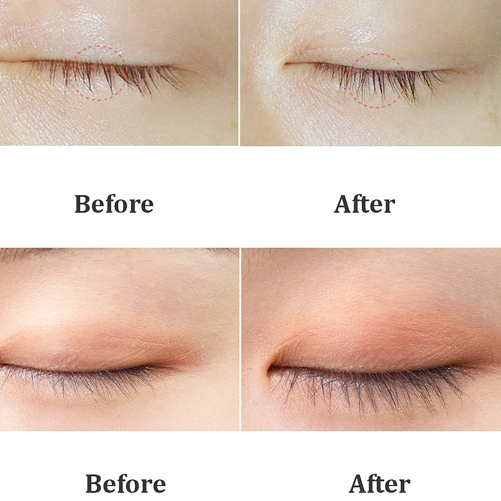 Tinh chất dưỡng mi Etude House My Lash Serum