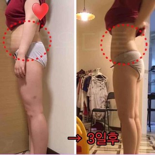 [FREE SHIP] Miếng Dán Tan Mỡ Bụng Timary Spa Gel Patch 42•C