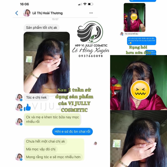 [Chính hãng] Tinh dầu bưởi vijully mọc tóc nhanh, từ thiên nhiên, dùng được cho cả nam và nữ | BigBuy360 - bigbuy360.vn