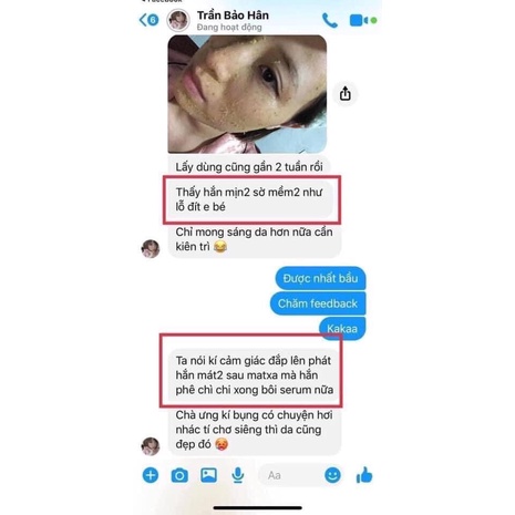 SERUM KHỔ QUA nguyên chất giảm mụn sáng da mờ vết thâm se khít lỗ chân lông giúp da sáng đều màu | BigBuy360 - bigbuy360.vn