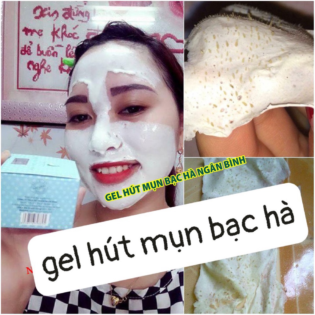 Gel bạc hà Ngân Bình hút mụn, lột mụn cám, đầu đen, da chết, lông tơ