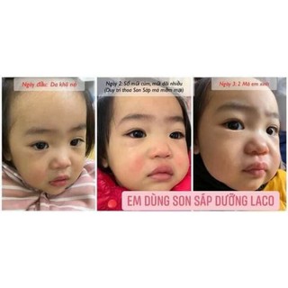 SON SÁP LACO GIÚP DƯỠNG MÔI  ,MỀM MÔI