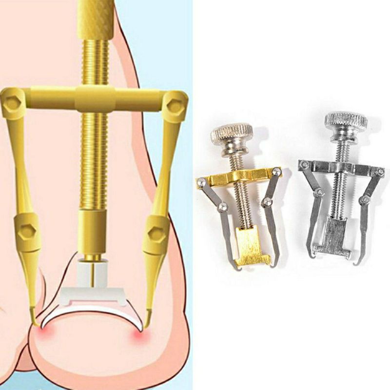 Dụng cụ chữa móng quặp